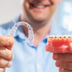 Invisalign, Zahnspange & Co.: Wann sind die Kosten steuerlich als außergewöhnliche Belastung absetzbar? 